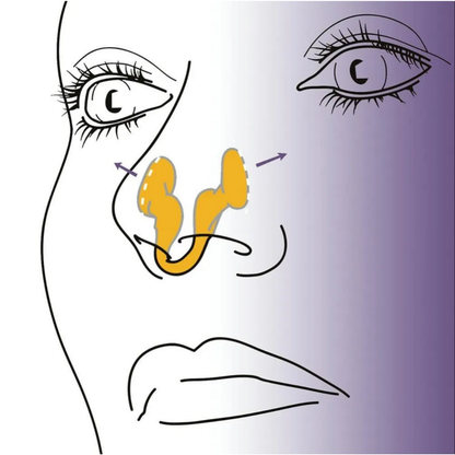 Sleepease – Anti-Snurk Neusclip voor Vrije Ademhaling