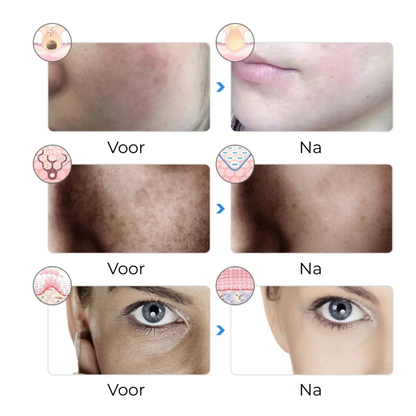 Phontonea – De slimme glow-up voor jouw huid